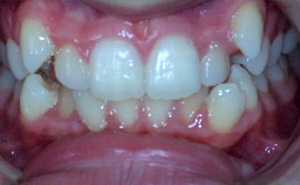 before two