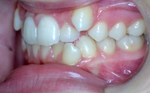 Before
